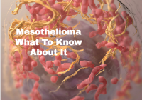 Mesothelioma What To Know About It